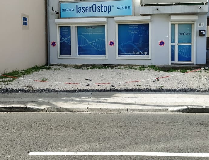 centre laser anti tabac saint denis de la réunion laserostop